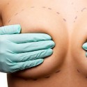 У операции по подтяжке груди появилась новая альтернатива «подкожный бюстгальтер»