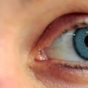Операция по смене цвета глаза при помощи имплантатов