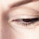 Лазерная пластика век